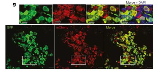 ▲在显微镜下，我们可以看到癌细胞如何“毒害”周围细胞（绿色标记的是癌细胞，红色的是特殊的荧光蛋白。那些被“毒害”的细胞看起来只有红色，没有绿色）（图片来源：参考资料[1]）