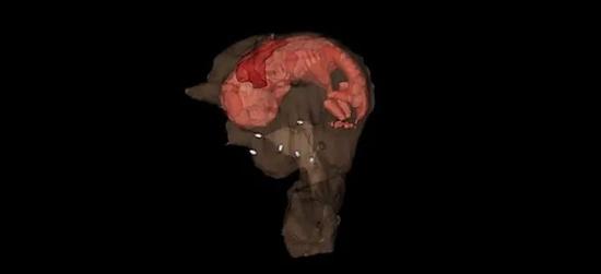 经过生物工程改造的兔子子宫 CT 图像，其中孕育着一个胎儿。图片来源：Wake Forest Institute for Regenerative Medicine （WFIRM）