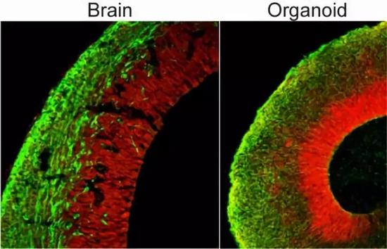 人类大脑（左），迷你大脑（右）相同区域结构图。图源：MRC Laboratory of molecular biology
