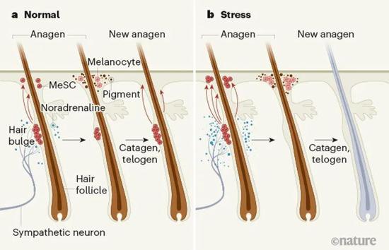 毛囊处黑素干细胞在压力下的变化机制