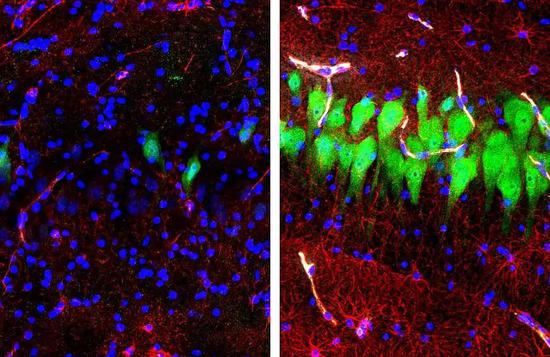 左图是未经治疗的大脑，右图是BrainEx。绿色表示神经元，红色表示星形胶质细胞，蓝色表示细胞核。