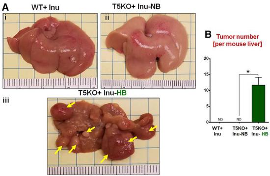 菊粉在T5KO模式小鼠中引发肝癌