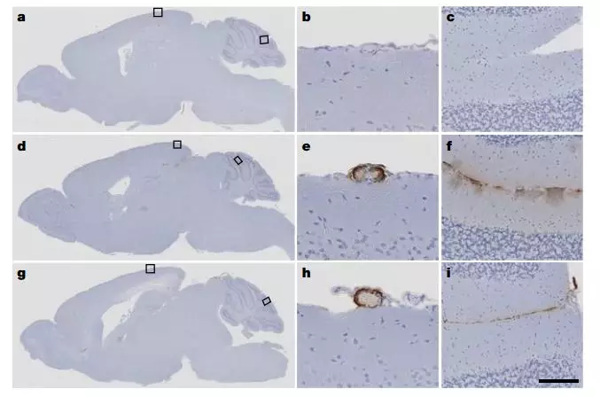 ▲注射了尸源性人类生长激素的小鼠大脑中（中，下）出现了沉积，而接受了重组人源生长激素的小鼠（上）则没有异常（图片来源：参考资料[2]）