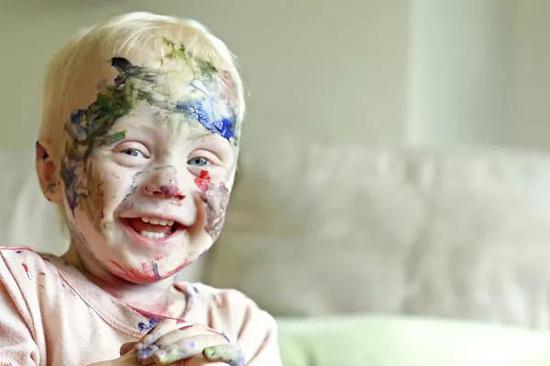 无论是哪种情况,异常染色体上携带大量的dna遗传信息都干扰了原本