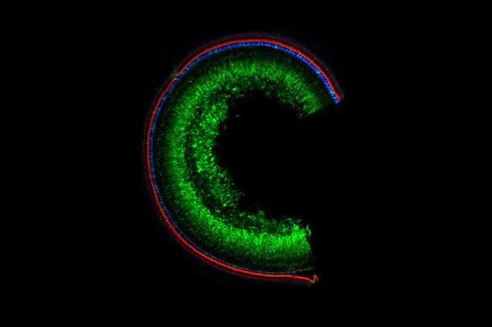 ▲小鼠耳蜗中，绿色的这些细胞转入了修复的Tmc1基因（图片来源：参考资料[2]；Credit： Olga Shubina-Oleinik， Boston Children‘s Hospital）