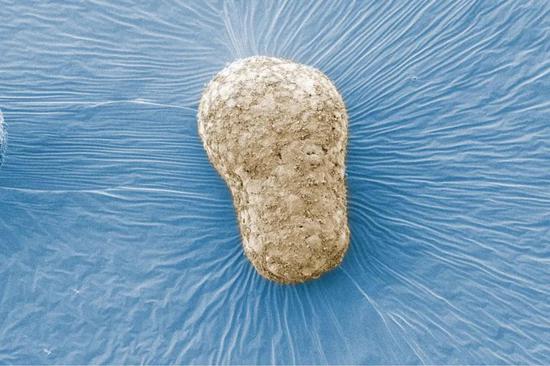 ▲人类类原肠胚的伪彩扫描电子显微镜照片（Credit： Naomi Moris）