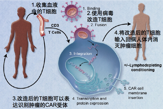 图15。 CAR-T细胞治疗