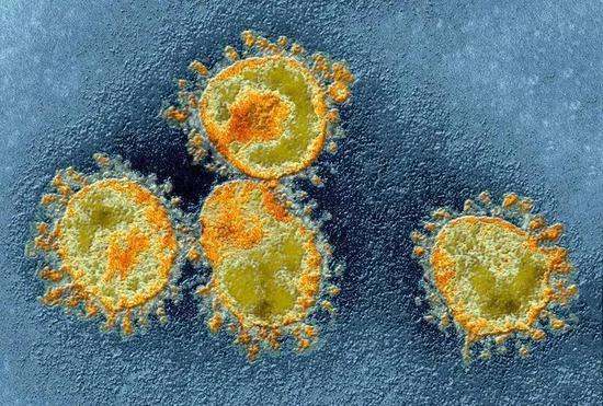 在透射电子显微镜下看到的冠状病毒的颗粒 | AMI Images / Science Photo Library