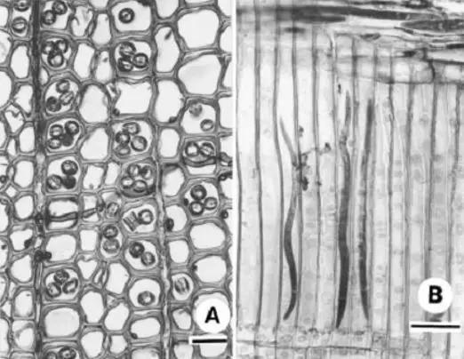 松树管胞中的松材线虫 左图:横切面 右图:纵切图 图片来源:参考文献[3