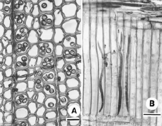 松树管胞中的松材线虫 左图：横切面 右图：纵切图 图片来源：参考文献[3]