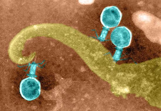 附着在细菌细胞壁残片上的病毒（来源：Biophoto Associates）