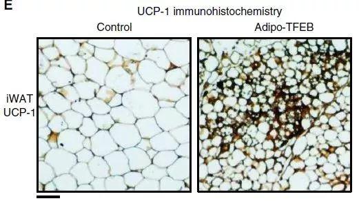▲TFEB增强脂肪细胞“褐变”（图片来源：参考资料[1]）