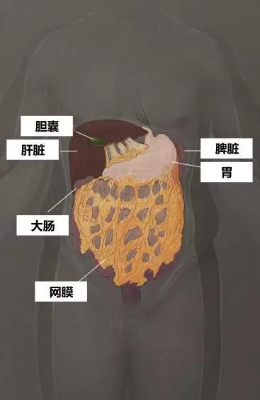 网膜解剖图示。网膜是身体腹部脂肪的主要聚集部位。它包裹着腹部器官，像围裙一样悬挂着。这种脂肪组织起着重要的免疫作用，但也是肥胖症患者慢性炎症的来源，可能导致代谢综合征。 网膜也是卵巢癌转移的常见部位。 制图：CATHERINE DELPHIA