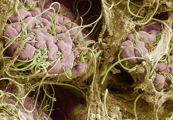 肠道中的分节丝状菌（绿色）会过度刺激感染孕鼠的免疫系统，影响胎儿的大脑发育（图片来源：参考资料[1]；Credit：Dan Littman, Alice Liang, Doug Wei and Eric Roth）