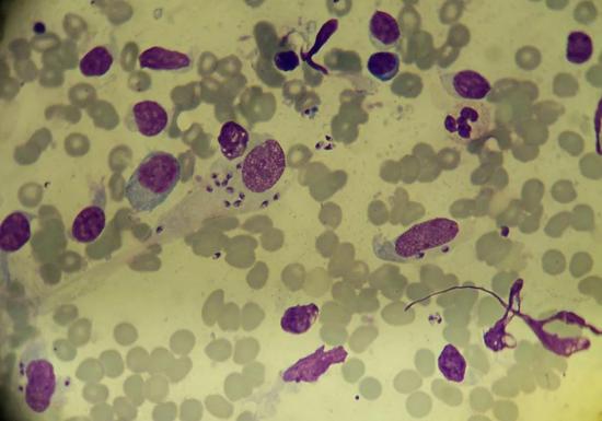 皮肤利什曼病患者组织中细胞内外的利什曼原虫。图片来源：Wikimedia， CC BY-SA 4.0