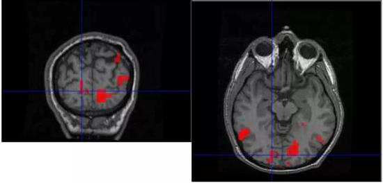  Jonathon Keats自己的fMRI图。
