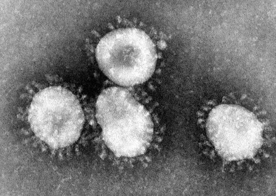 造成普通感冒的冠状病毒的电镜照片，病毒周围有王冠一样伸出的刺状突起（图片来源：维基百科）