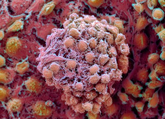 图丨人类胚胎干细胞被诱导进入胚胎样结构