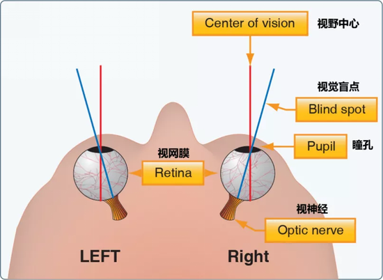 世界首个3D人工眼球：电化学仿生眼 复制了人眼的曲面结构