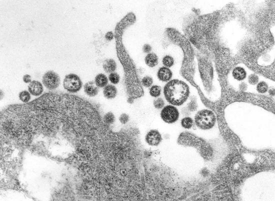 拉沙病毒（图片来源：PHIL/public domain）