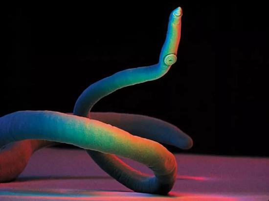 血吸虫（Schistosoma）图片来源：https：//www.newscientist.com