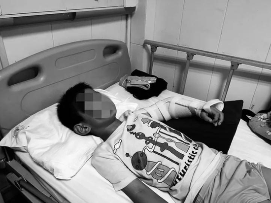 图2 骑行电动平衡车摔伤住院的儿童（图片来自网络）