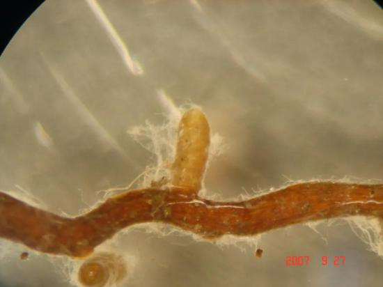 图2 真菌菌丝与油松根系共生形成了菌根（图片由辽宁省林业科学研究院王琴博士提供）