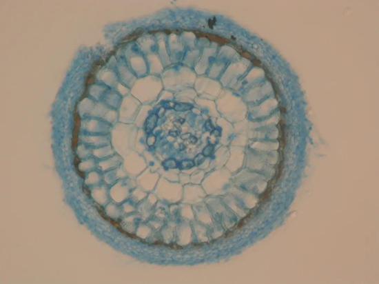图5 解剖镜下的油松外生菌根（上）及其横剖面（下）（图片由辽宁省林业科学研究院王琴博士提供）