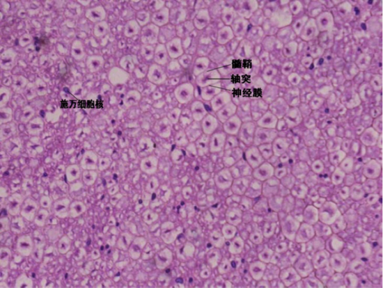 脊神经节切片图片图片