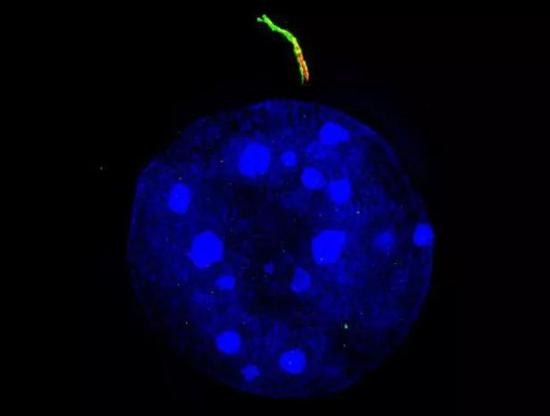 很多细胞上都长了纤毛：标记绿色荧光的是细胞纤毛，蓝色荧光的是细胞核。（图片来源：www.genengnews.com）