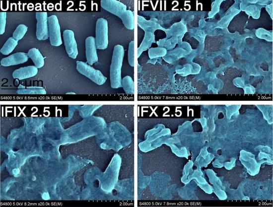 LCs破坏大肠杆菌包膜（图片来源：Coagulation factors VII， IX and X are antibacterial proteins against drug-resistant Gram-negative Bacteria）