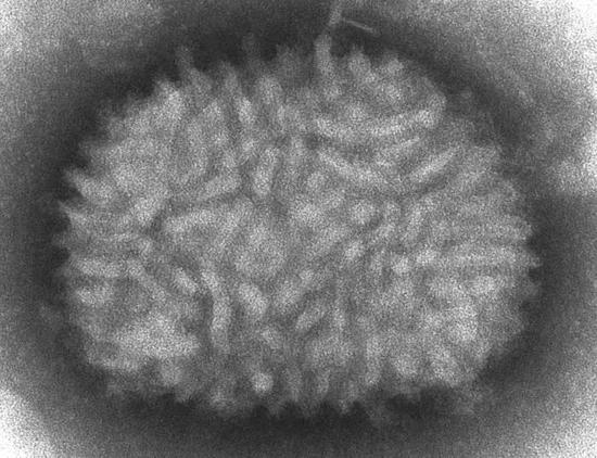 牛痘病毒（来源：维基百科）