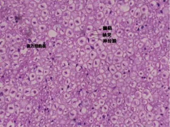 坐骨神经横切（H/E染色），图中每一个泡泡状的结构都是一根神经纤维的横截面。每根神经纤维都有自己独立的髓鞘（绝缘层）和轴突（传导神经信号的“芯”），彼此之间互相独立 | jpkc.lzmc.edu.cn