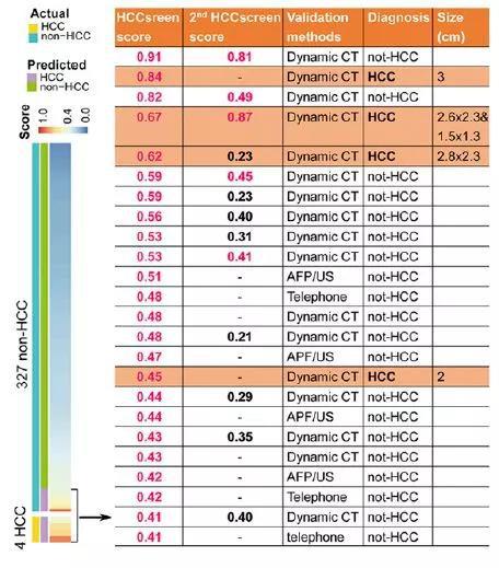 ▲HCCscreen在无症状的乙肝病毒携带者中筛查出4例肝癌（图片来源：参考资料[1]）