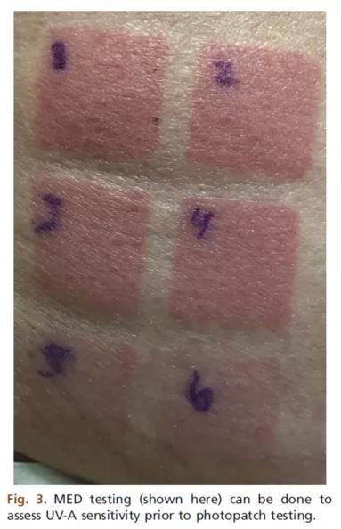 《光敏的人能做光电医美项目吗?》