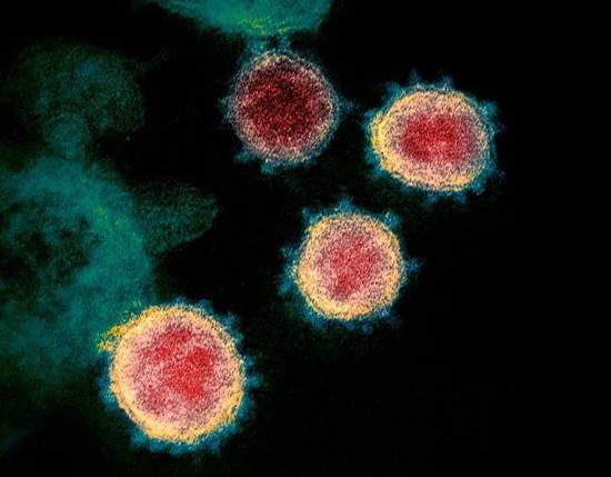  电子显微镜拍摄的新冠病毒。图片来源：NIH