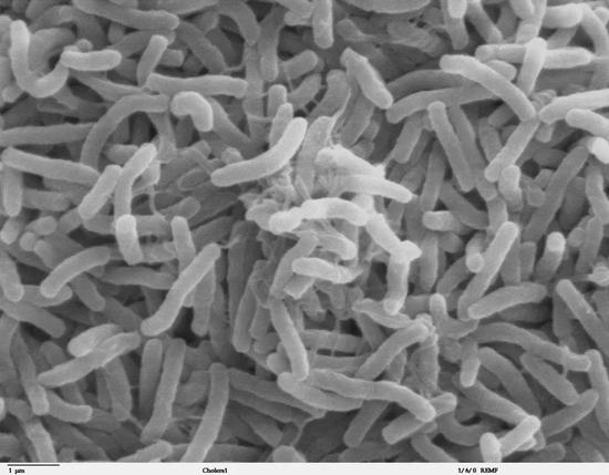 霍乱弧菌 Vibrio cholerae 图片来源：wikipedia