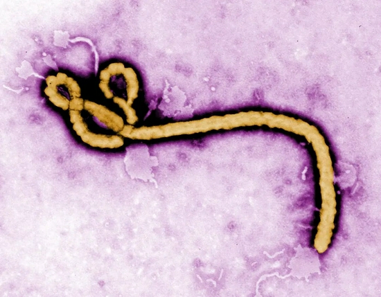 　埃博拉病毒|FREDERICKA.MURPHY/CDC