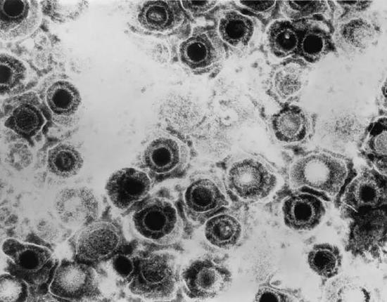 透射电镜下的单纯疱疹病毒。| 图片来源：Wikipedia