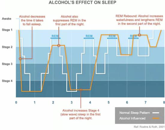 酒精对睡眠结构的影响