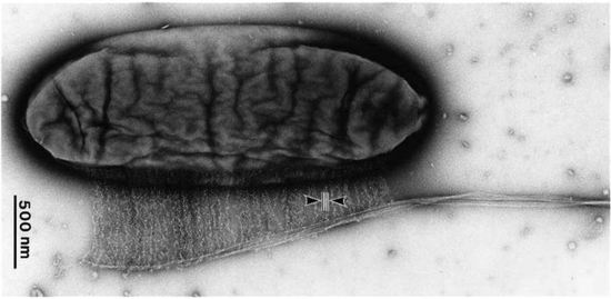 显微镜下制造纤维的木质醋酸菌&nbsp;|&nbsp;图源:hirai et al. 2002