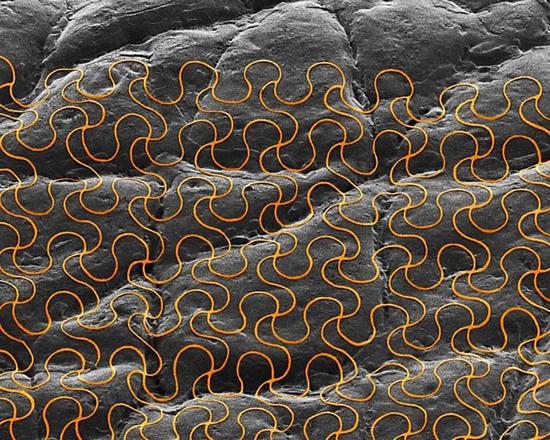 打印在皮肤上的柔性电路的显微镜像；即使被拉伸，这种柔性电路仍然能工作。来源：John Rogers，伊利诺伊大学/SPL