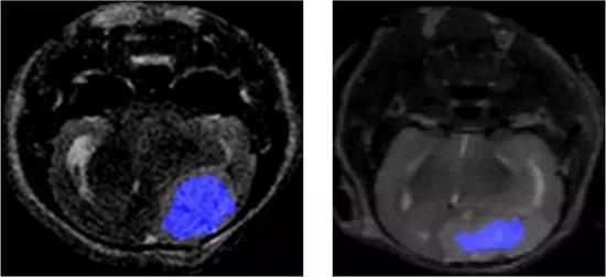 光学分子影像断层可视化小鼠颅内脑胶质瘤区域（蓝色区域）