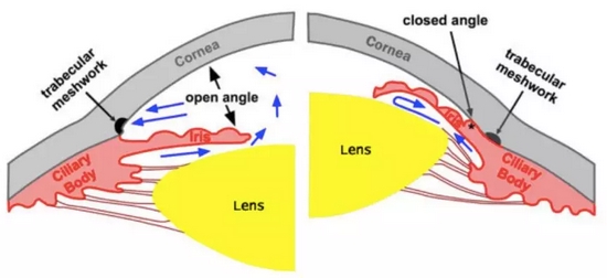 曹操为什么总是头痛？（不是高血压）