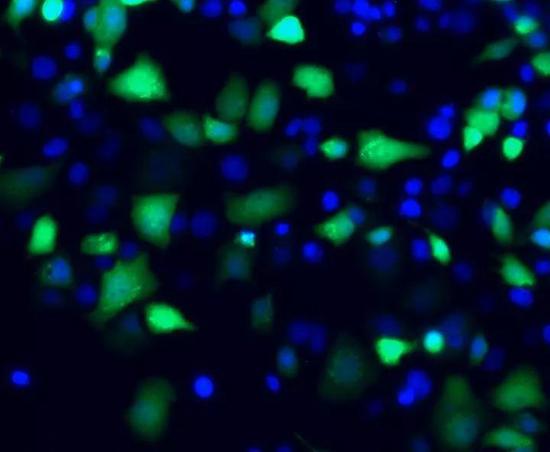 ▲蓝色标记的是人类肝细胞的细胞核，绿色荧光标记了乙肝病毒的cccDNA（图片来源：Lei Wei and Alexander Ploss， Princeton University）