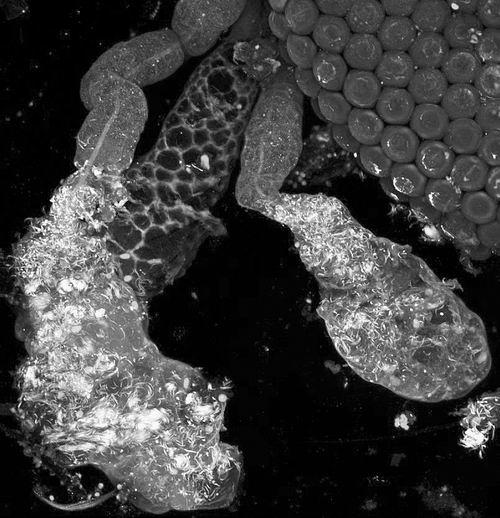 雌性按蚊的唾液腺图片来源：约翰斯·霍普金斯大学