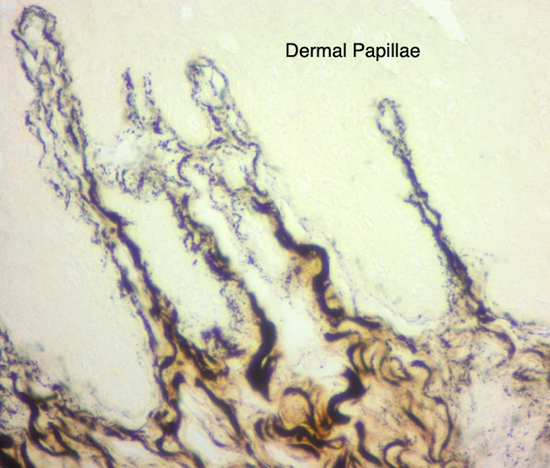 海豚阴蒂皮肤的真皮乳头（Dermal Papillae）， 真皮乳头有非常敏感的神经末梢 