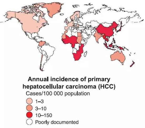  图2。 原发性肝细胞癌的年发病率全球分布（图片来源：Lavanchy， D。 etl， Journal of Viral Hepatitis， 2004。）