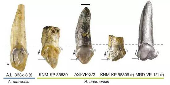 门齿对比照片，左1属于南方古猿阿法种，其余属于南方古猿湖畔种（图片来源：论文截图）