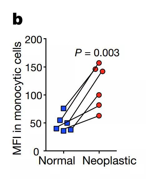 ▲LILRB4在癌变单核细胞表面的表达量更高（图片来源：参考资料[1]）
